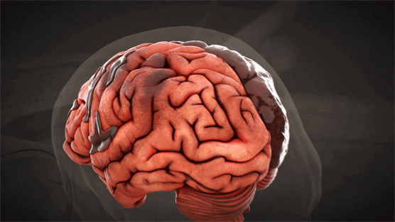 image of brain injury